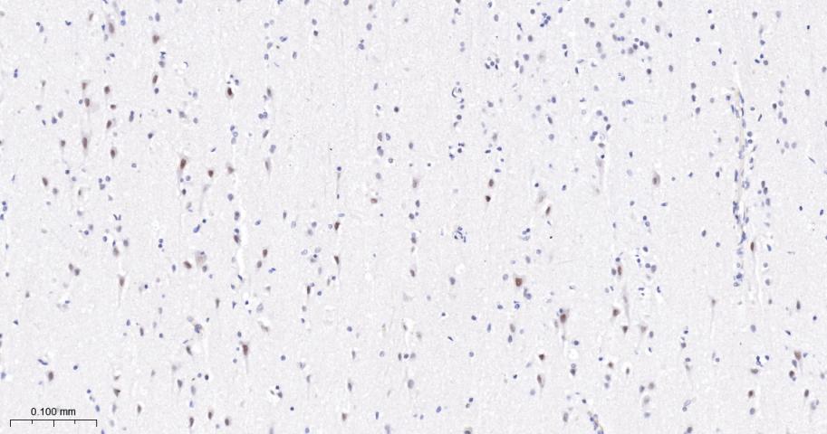 磷酸化信号转导和转录激活因子3重组兔单抗