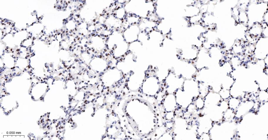 磷酸化信号转导和转录激活因子3重组兔单抗