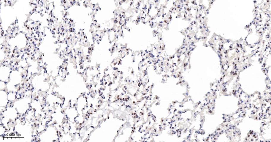 磷酸化信号转导和转录激活因子3重组兔单抗