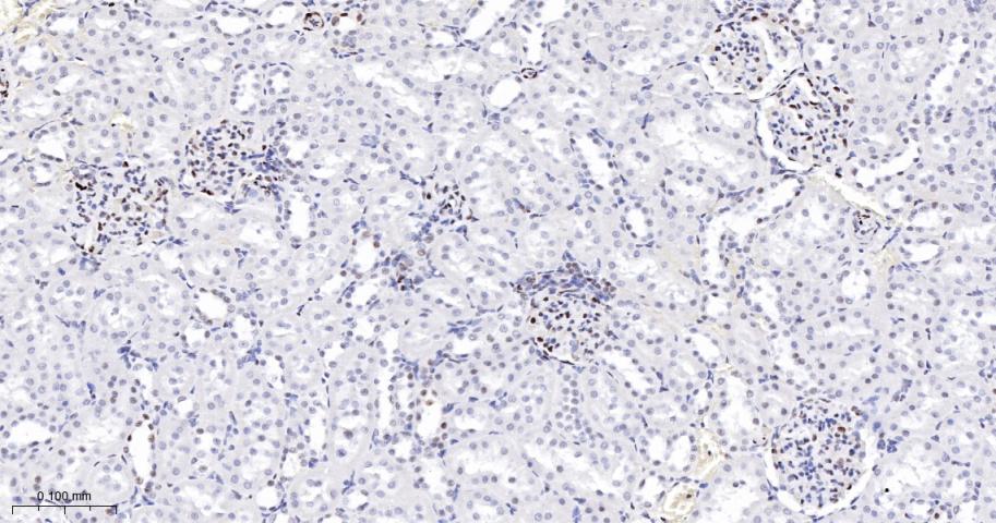 磷酸化信号转导和转录激活因子3重组兔单抗