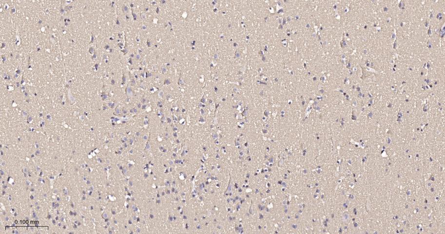 神经生长相关蛋白43重组兔单克隆抗体