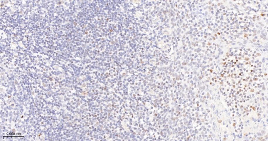 磷酸化信号转导和转录激活因子3重组兔单抗