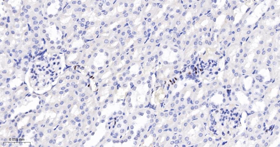 磷酸化信号转导和转录激活因子3重组兔单抗