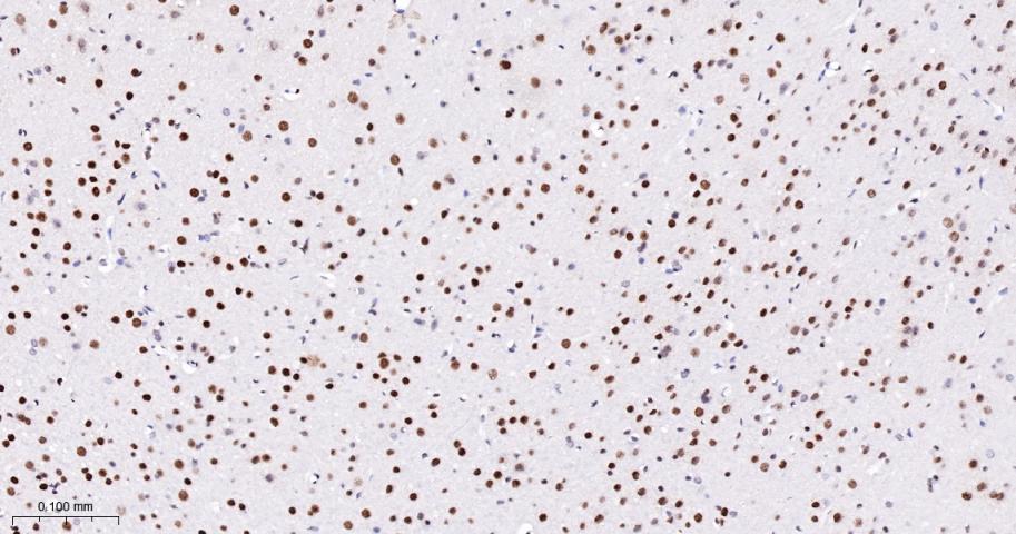 磷酸化信号转导和转录激活因子3重组兔单抗