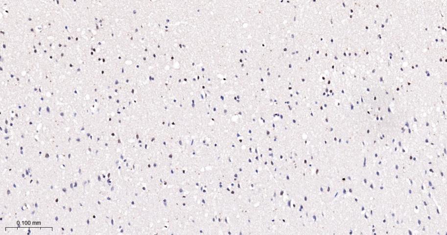 磷酸化信号转导和转录激活因子5a重组兔单抗