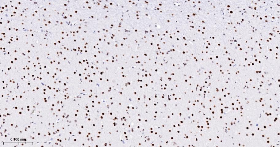 磷酸化信号转导和转录激活因子3重组兔单抗