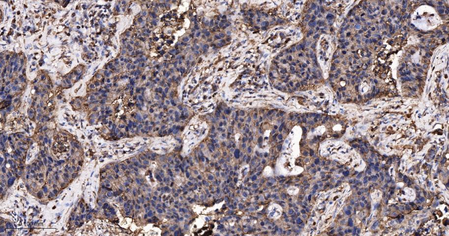 葡萄糖转运蛋白1重组兔单抗