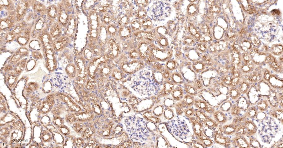 血管内皮生长因子受体1重组兔单抗