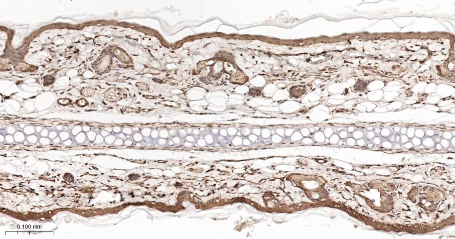 p21激活激酶2重组兔单抗
