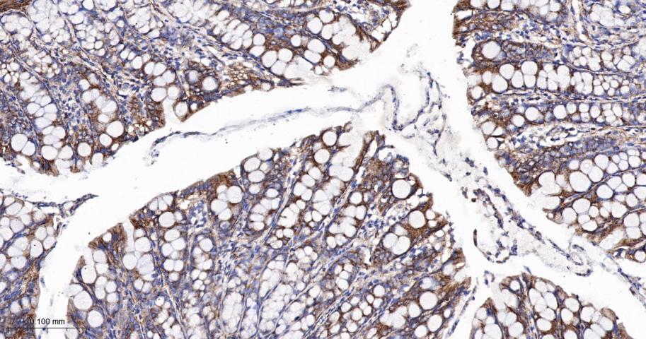 肾上腺素能受体β2重组兔单抗