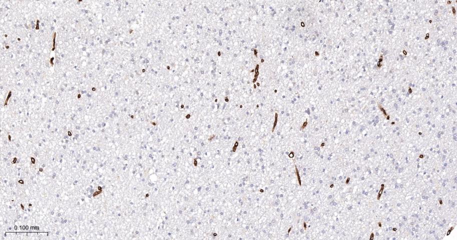 IV型胶原蛋白重组兔单抗