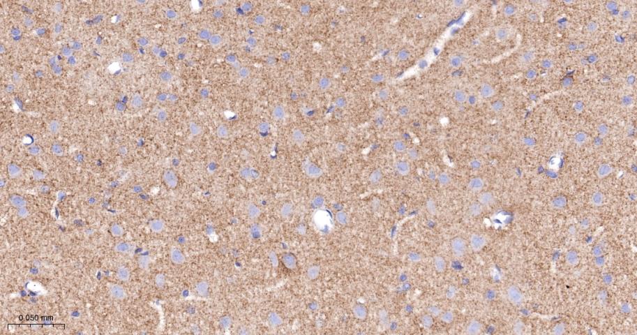 血管内皮生长因子受体1重组兔单抗