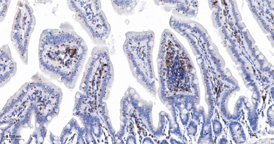 白细胞F肌动蛋白结合蛋白重组兔单抗