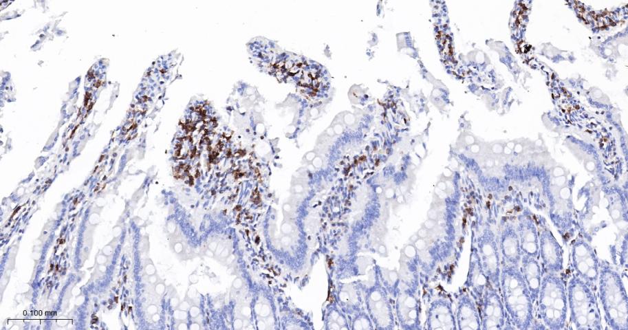 白细胞F肌动蛋白结合蛋白重组兔单抗