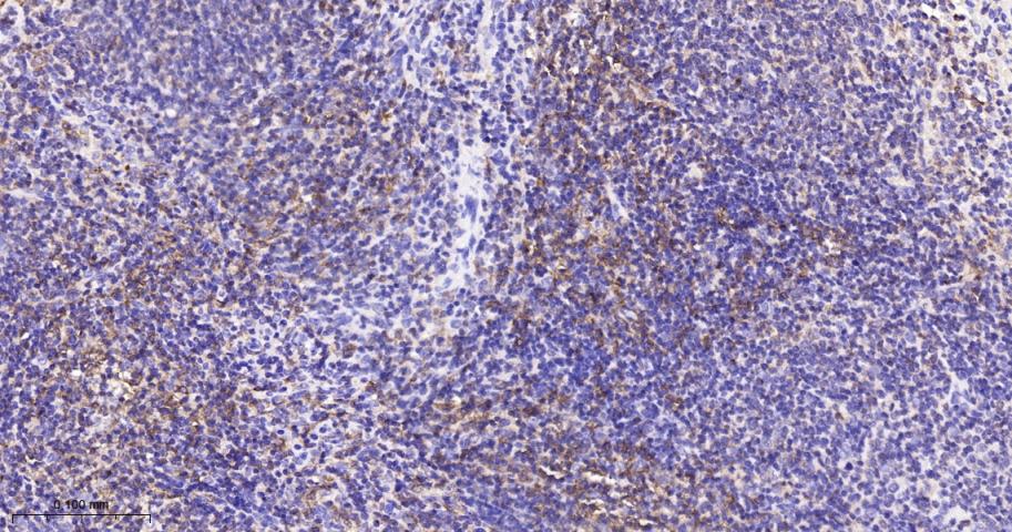 白细胞F肌动蛋白结合蛋白重组兔单抗