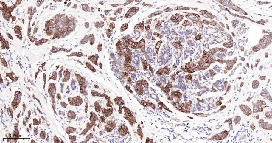 整合素β4重组兔单抗