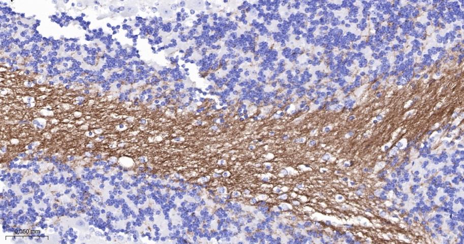髓鞘少树突胶质细胞糖蛋白重组兔单抗