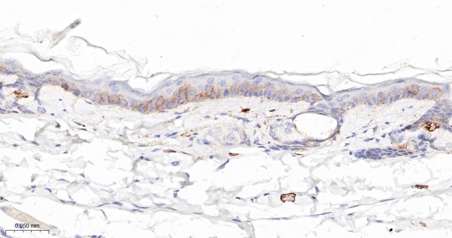 整合素β4重组兔单抗