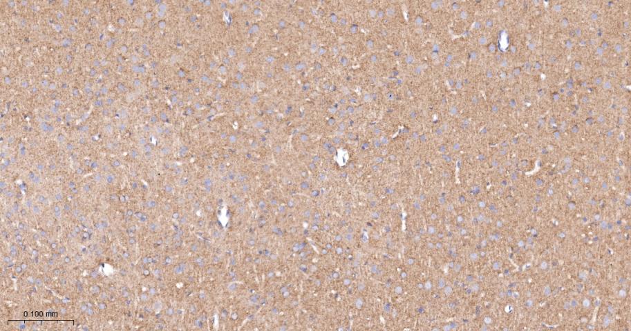 血管内皮生长因子受体1重组兔单抗