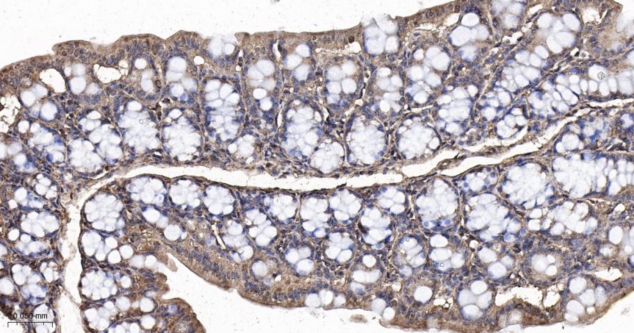 p21激活激酶2重组兔单抗