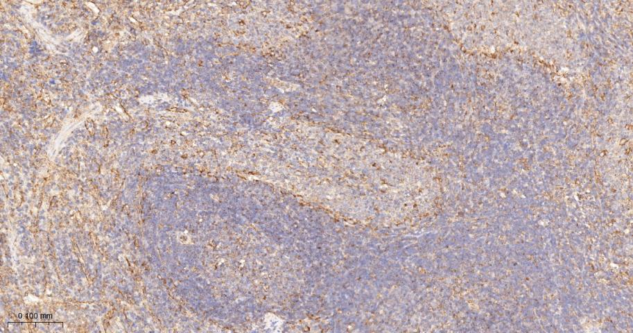 血管内皮生长因子受体1重组兔单抗