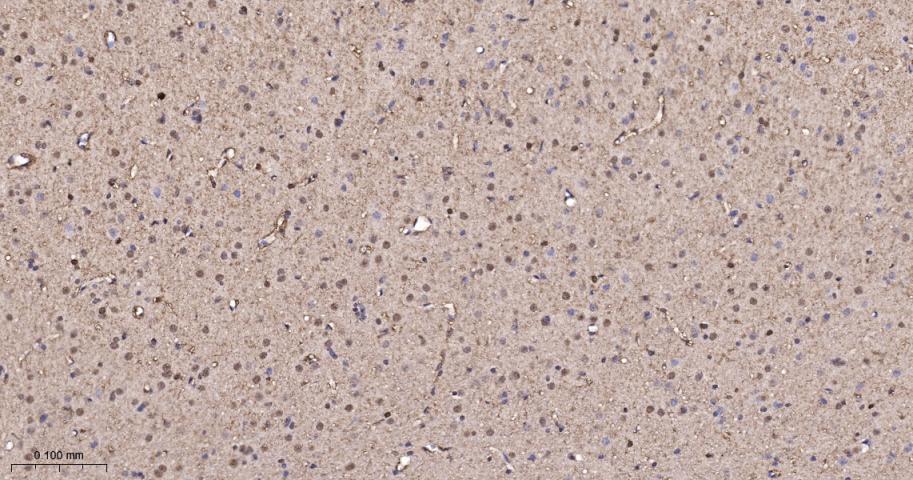 p21激活激酶2重组兔单抗