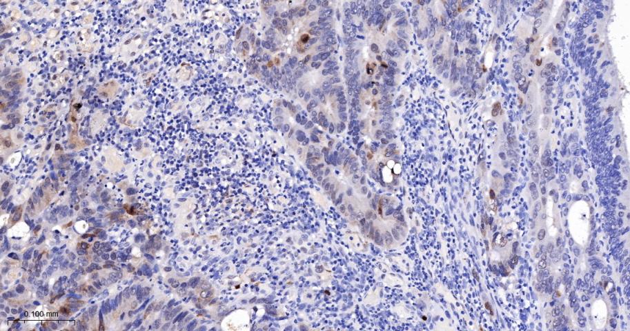 磷酸化氨基末端激酶1/2/3重组兔单抗