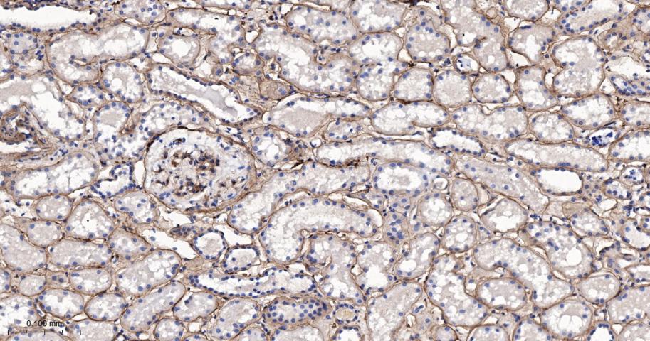 IV型胶原蛋白重组兔单抗