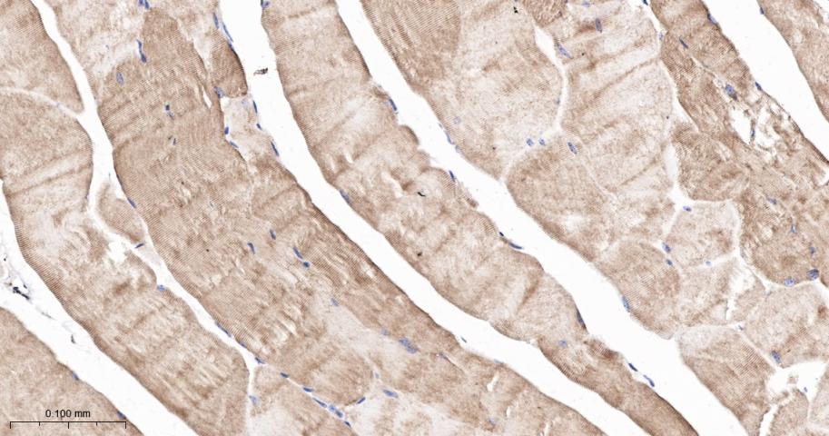 网蛋白重组兔单抗