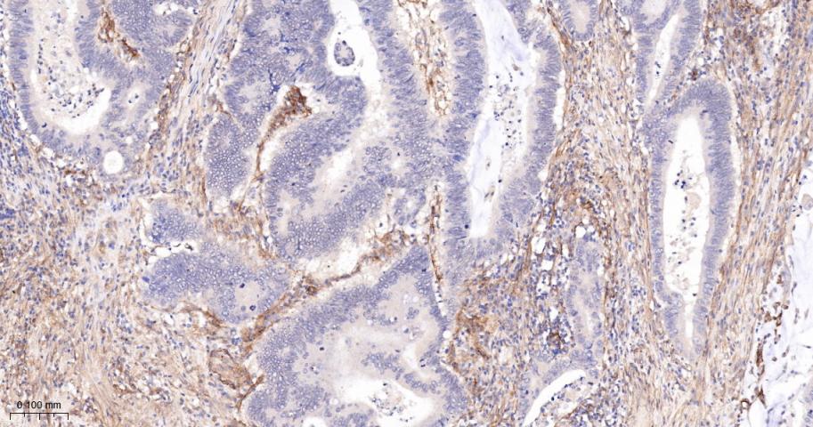 血小板源性生长因子受体B/PDGFRβ重组兔单抗