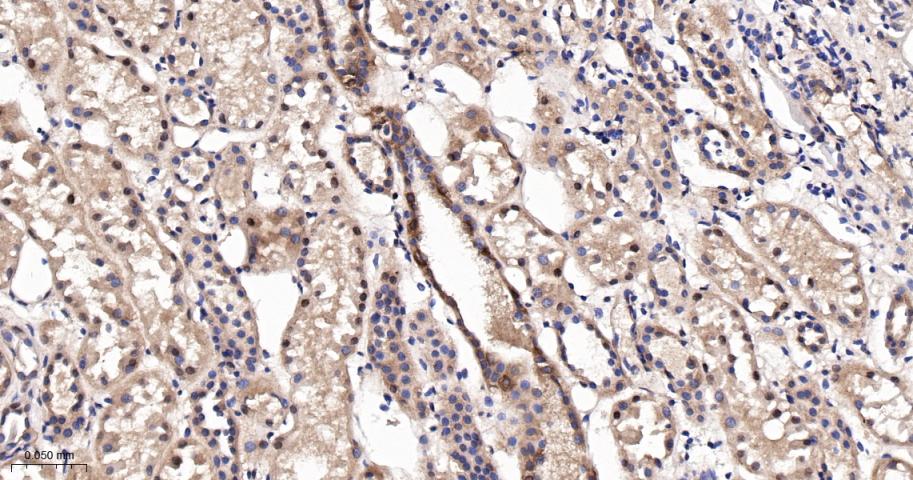 p21激活激酶2重组兔单抗