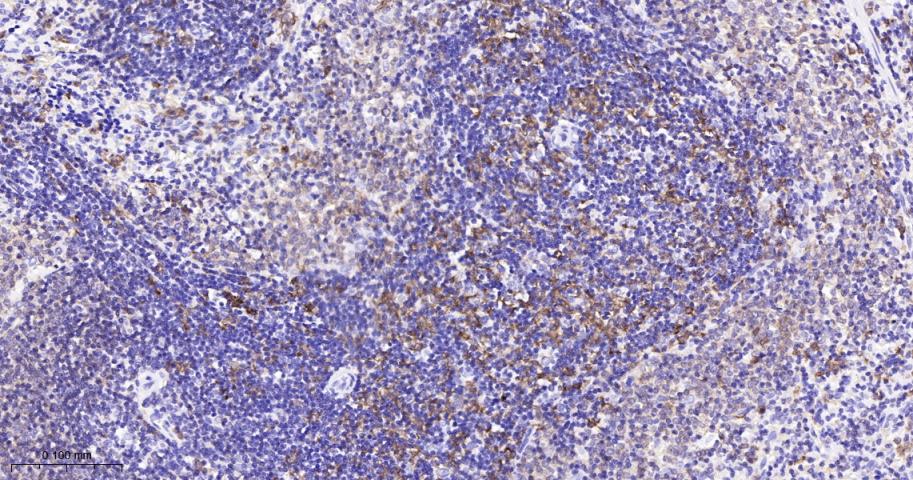 白细胞F肌动蛋白结合蛋白重组兔单抗