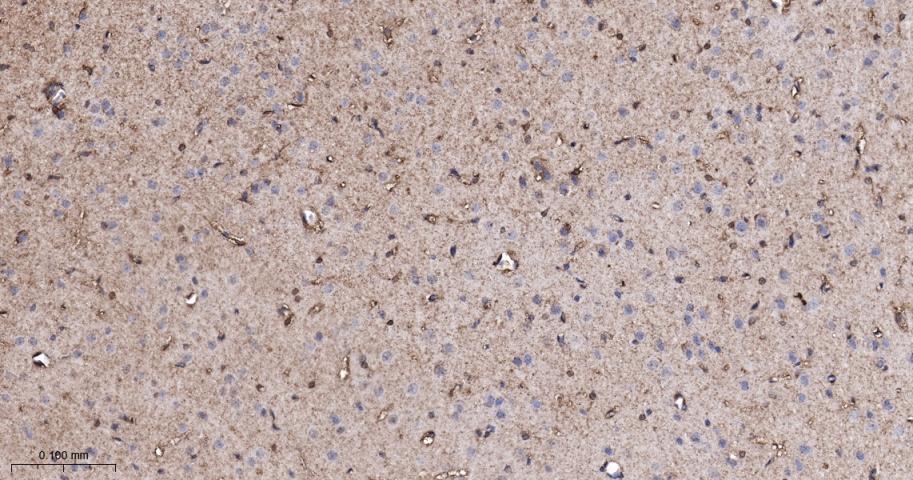 p21激活激酶2重组兔单抗