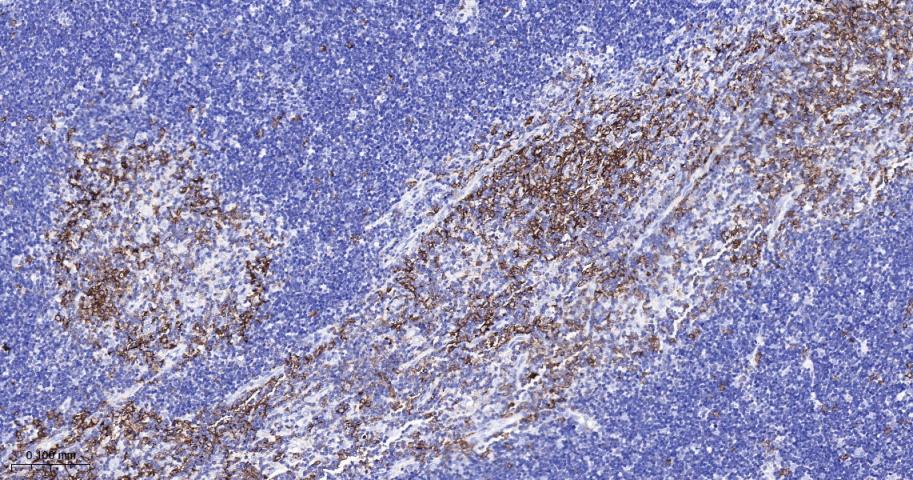 白细胞F肌动蛋白结合蛋白重组兔单抗