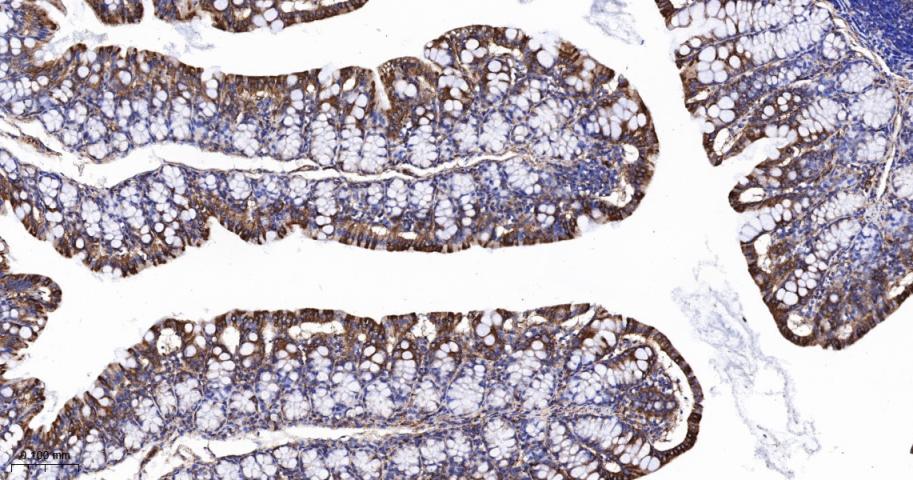 肾上腺素能受体β2重组兔单抗