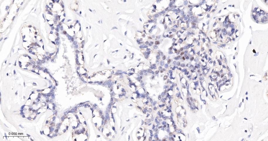 磷酸化信号转导和转录激活因子3重组兔单抗