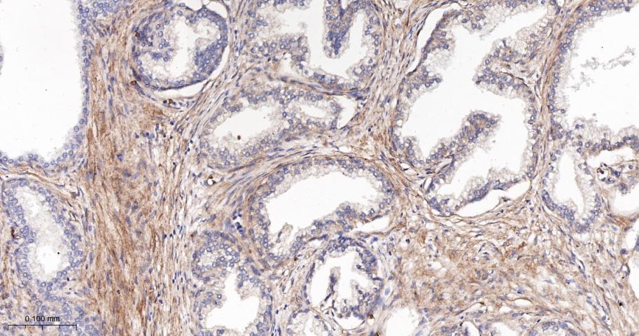 IV型胶原蛋白重组兔单抗