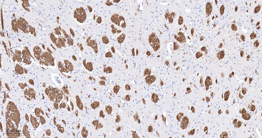 髓鞘少树突胶质细胞糖蛋白重组兔单抗