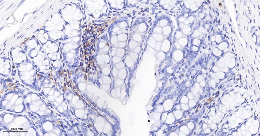 白细胞F肌动蛋白结合蛋白重组兔单抗
