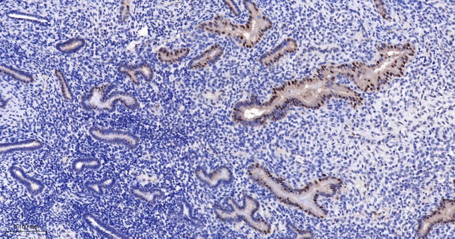 磷酸化氨基末端激酶1/2/3重组兔单抗
