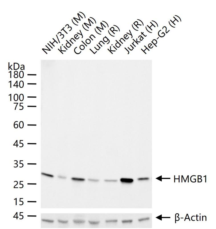 高迁移率族蛋白B1重组兔单抗