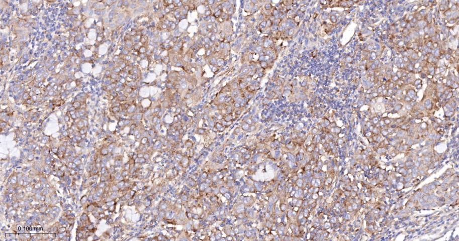 血管内皮生长因子受体1重组兔单抗