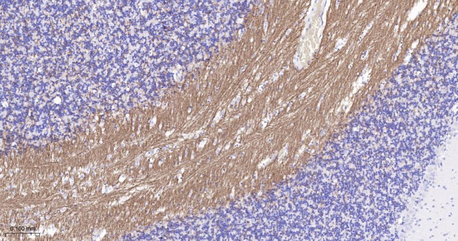 髓鞘少树突胶质细胞糖蛋白重组兔单抗
