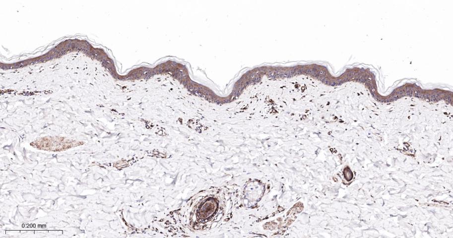 网蛋白重组兔单抗