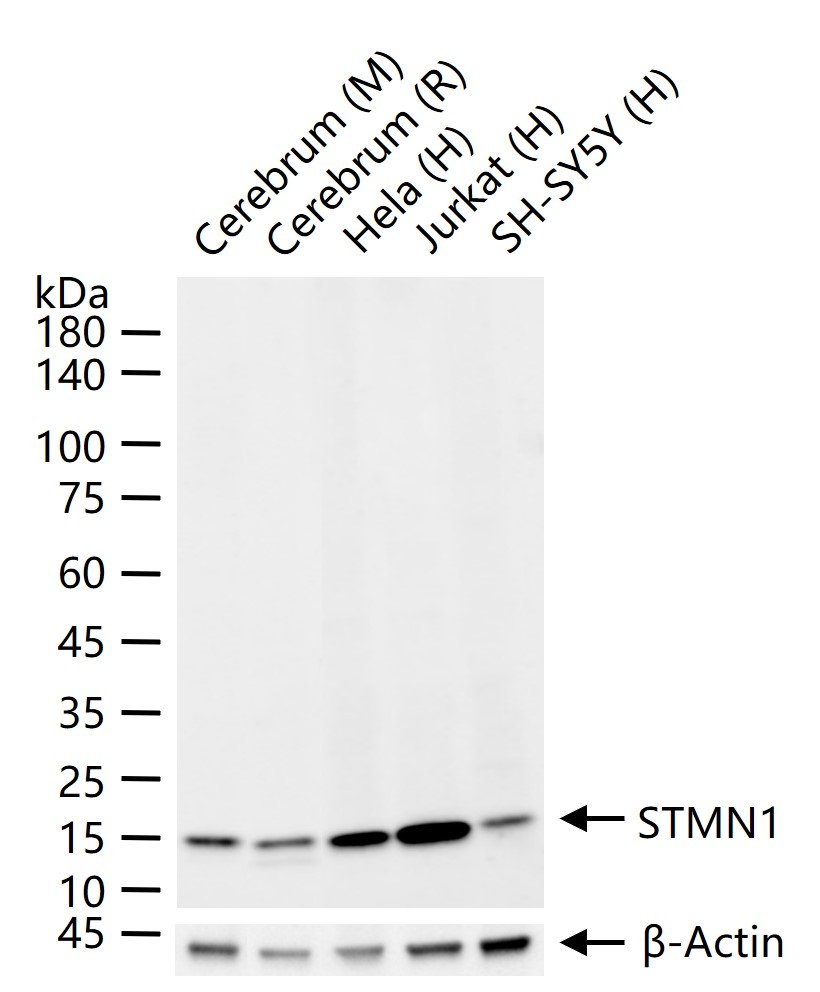 白血病相关蛋白18/癌蛋白18重组兔单抗