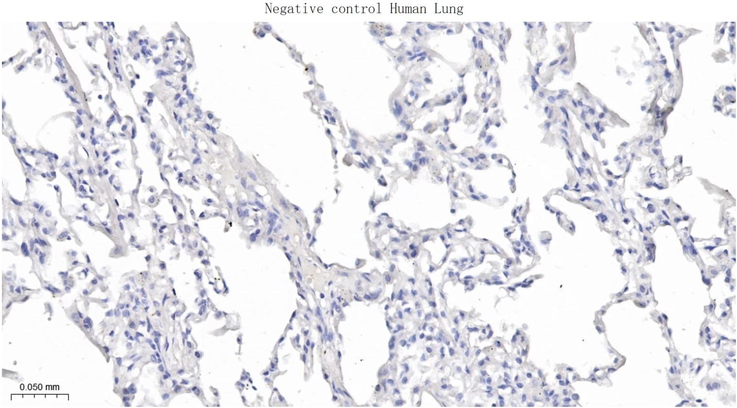 髓鞘少树突胶质细胞糖蛋白重组兔单抗