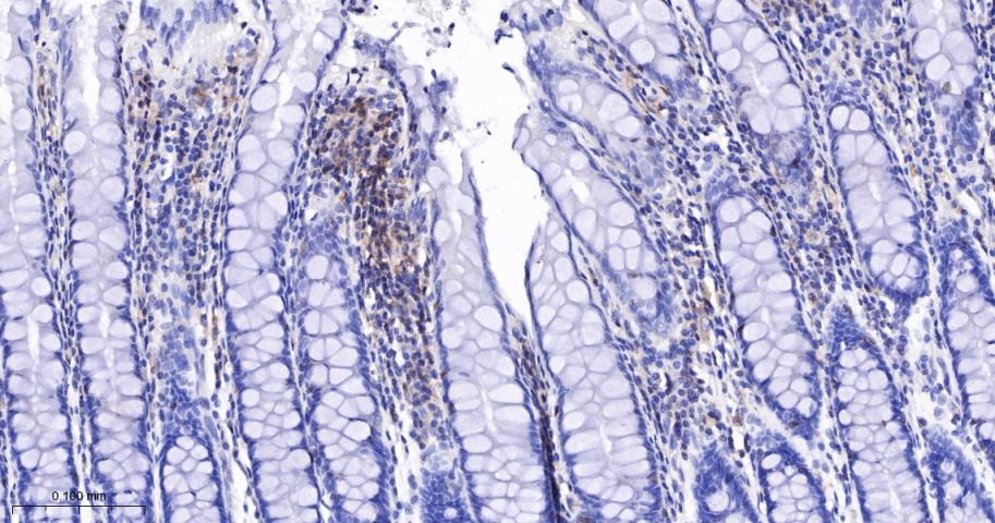 白细胞F肌动蛋白结合蛋白重组兔单抗