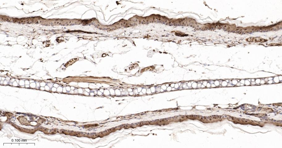 p21激活激酶2重组兔单抗