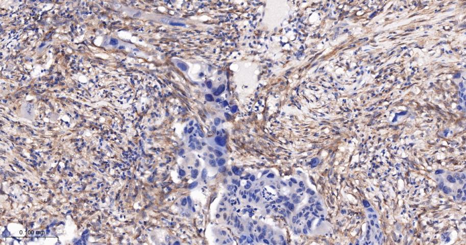 血小板源性生长因子受体B/PDGFRβ重组兔单抗