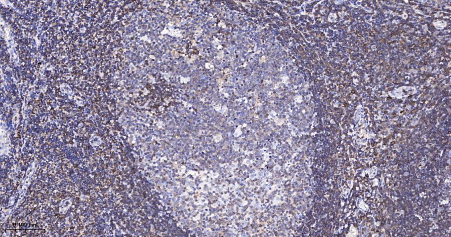 白细胞F肌动蛋白结合蛋白重组兔单抗